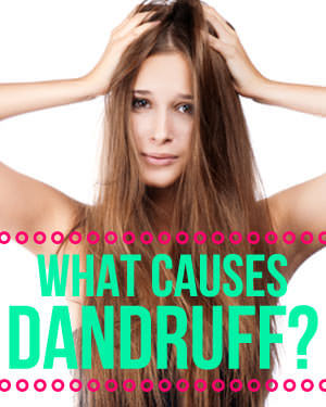What causes dandruff?