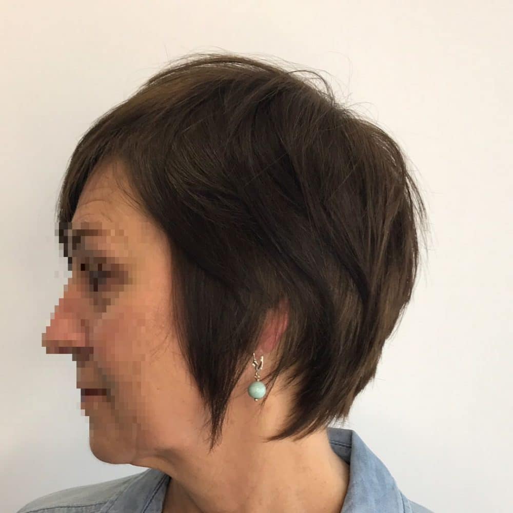 Pixie Haircuts For Fine Thin Hair Over 70 - Hairstyles For Over 70 Year Old Woman