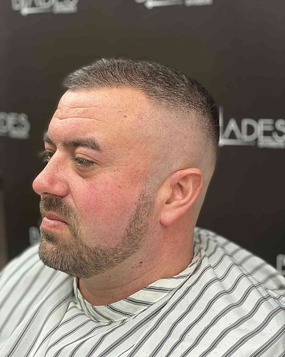 Very Short Cut with High Bald Skin Fade and Sideburns on Men with Thin Hair